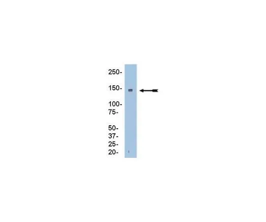 62-8389-30　［已停用］反RFC1;100μg　09-094