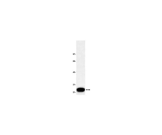 62-8383-79　［已停用］抗RKIP;200μg　07-137
