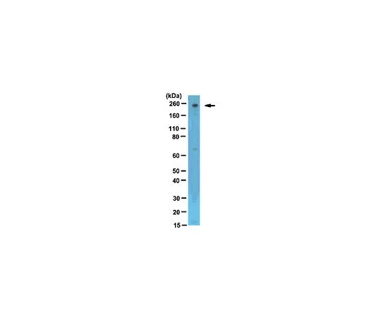 62-8383-15　［已停用］反米-2b (CHD4);100μL　06-1306