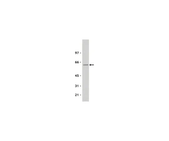 62-8370-57　［已停用］抗Src,克隆GD11;200μg　05-184