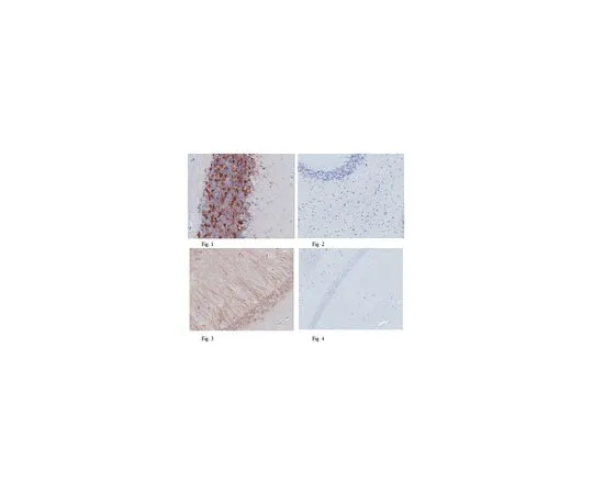62-8469-52　［已停用］抗ADAP1;100μg　ABS179