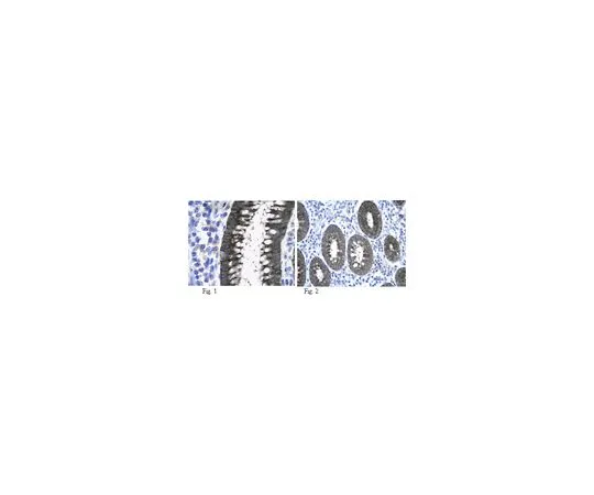 62-8388-88　［已停用］反WNK2;100μL　7-61