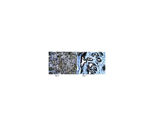62-8454-64　［已停用］抗RalBP1;100μg　AB10551