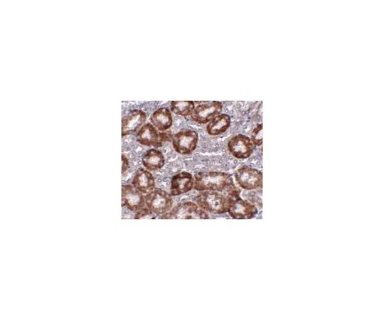 62-8467-51　［已停用］抗RTP801　ABN483