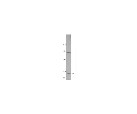 62-8383-62　［已停用］抗GSTM1;100μg　07-054