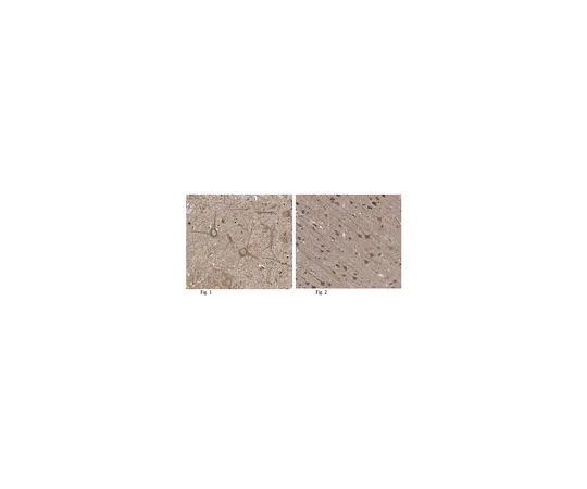 62-8466-61　［已停用］反CAPS-1　ABN329