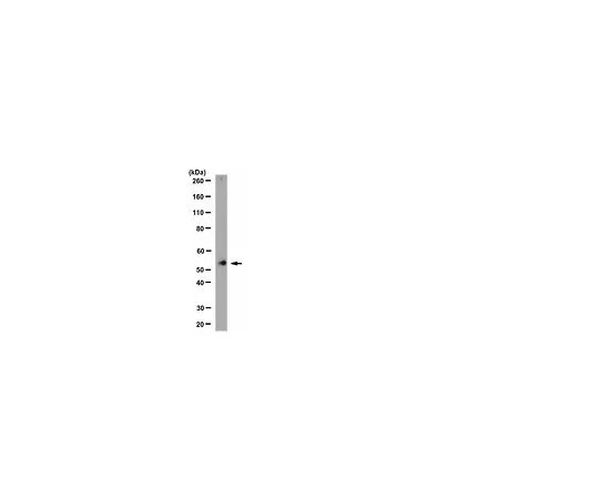62-8455-08　［已停用］抗烟碱乙酰胆碱受体α3;100μg　AB15320
