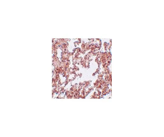 62-8467-56　［已停用］反SRPX2　ABN488