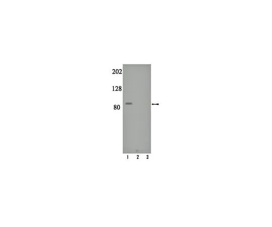 62-8386-91　［已停用］抗磷-PKCγ (Thr655);100μL　07-879