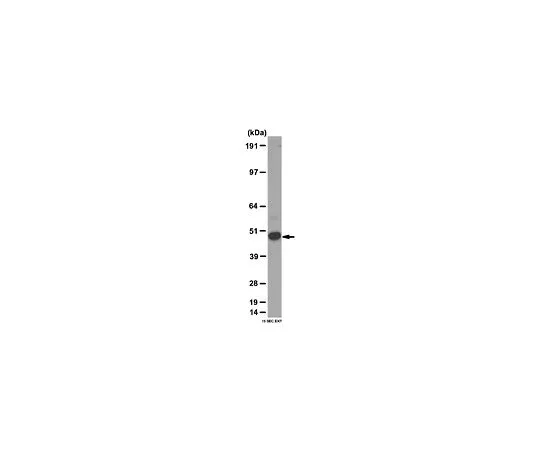 62-8459-56　［已停用］抗BMPR-1B;100μg　ABD50