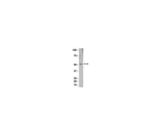 62-8386-10　［已停用］反SKAP55;100μg　07-651