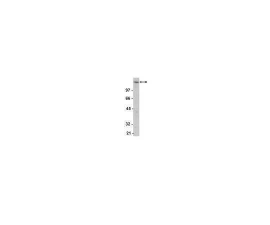 62-8382-14　［已停用］抗EGFR;200μg　06-847