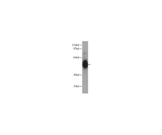 62-8467-66　［已停用］抗CHRNA5　ABN503