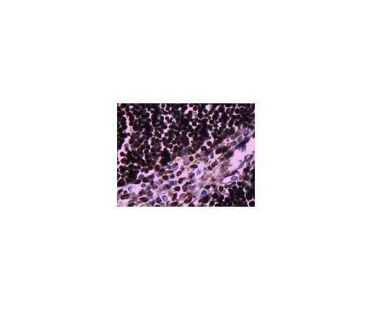 62-8383-03　［已停用］抗IL-33RST2 (IL1RL1);100μg　06-1116