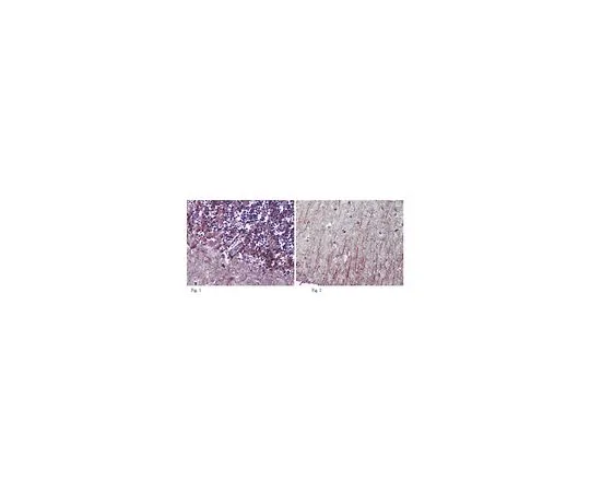 62-8465-55　［已停用］抗LXRbeta测试;100μg　ABN65