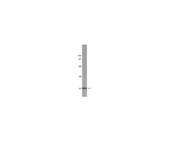 62-8372-05　［已停用］抗γC1qR,克隆74.5.2;200μL　05-627