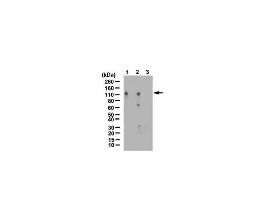 62-8388-15　［已停用］抗HIF-1α，羟脯氨酸 (Pro402);100μg　07-1585
