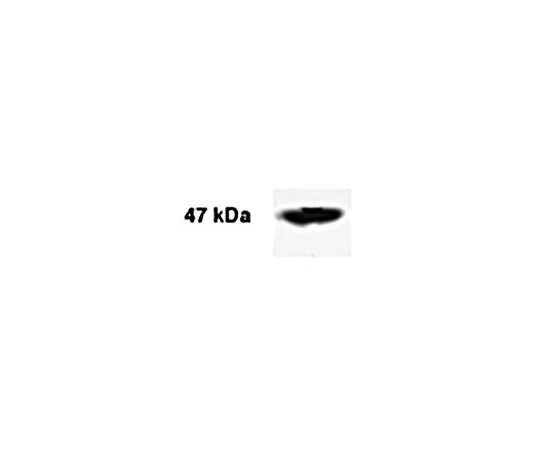 62-8448-82　［已停用］反AMACR;100μg　AB4235