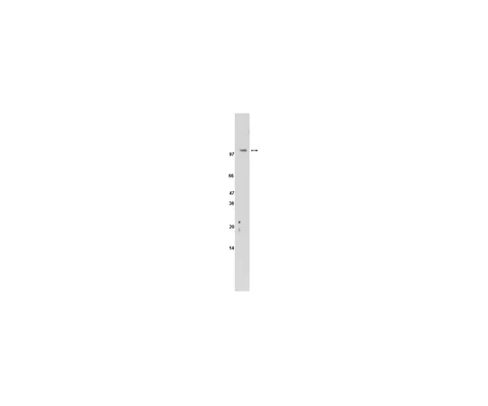 62-8368-33　［已停用］抗甾醇调节元件结合蛋白2 (SREBP-2) ，克隆2545;200μL　04-479