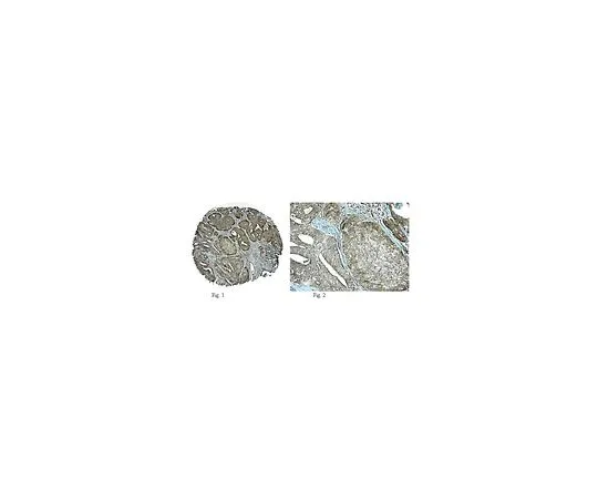 62-8388-71　［已停用］防夹4;100μg　7-66