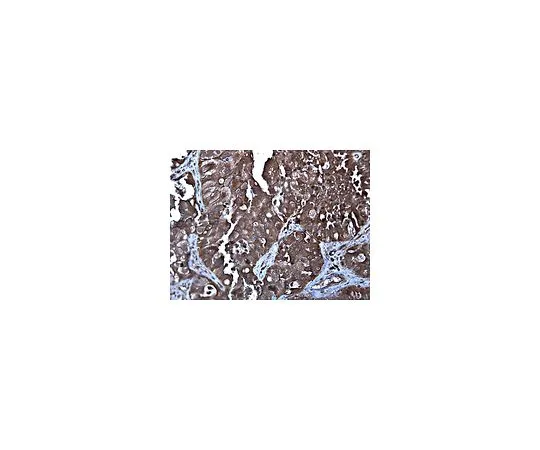 62-8382-98　［已停用］反关联;100μg　06-1105
