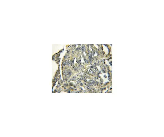 62-8457-52　［已停用］抗HBP1　ABC295
