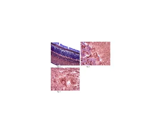 62-8465-71　［已停用］抗OPA1;100μg　ABN95