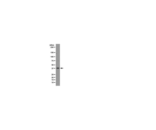 62-8374-81　［已停用］抗PURA,克隆2B7;100μg　05-1361