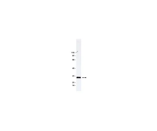 62-8381-99　［已停用］抗RhoGDI;200μg　06-730
