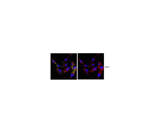 62-8472-47　［已停用］反WAM;100μg　ABT60
