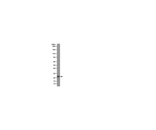 62-8369-10　［已停用］抗Y14,克隆1F12;100μg　04-1464
