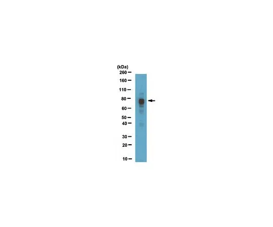 62-8460-50　［已停用］抗MeCp2;100μg　ABE171