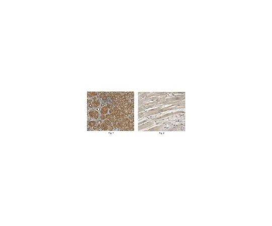 62-8470-52　［已停用］反C1QA　ABS519
