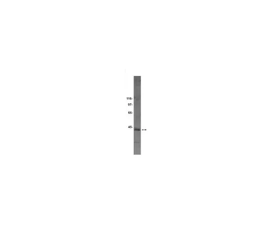 62-8383-98　［已停用］抗Sec61α;100μL　07-204