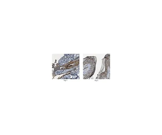 62-8457-13　［已停用］抗FABP5抗体猫。不，是ABC216　ABC216