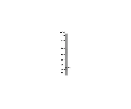 62-8369-60　［已停用］抗激活诱导胞苷脱氨酶 (AID) ，克隆EK2-5G9;100μg　04-1593
