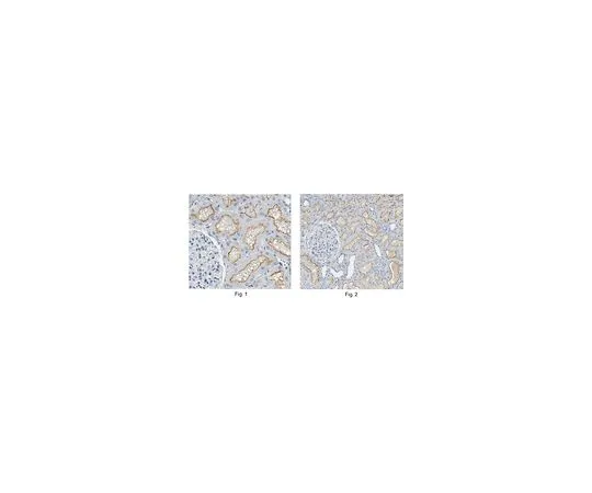 62-8457-34　［已停用］抗血管紧张素转换酶　ABC246