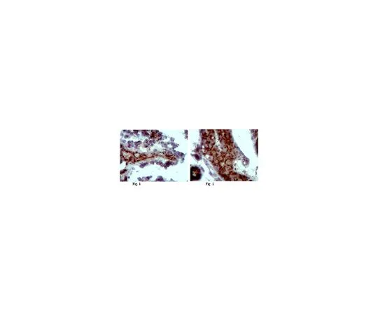 62-8456-49　［已停用］抗Noxia;100μg　ABC50