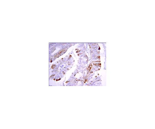 62-8387-26　［已停用］抗DAPK2;100μg　07-1229