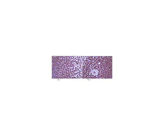 62-8382-89　［已停用］抗IL-12R-β-1;100μg　06-1089