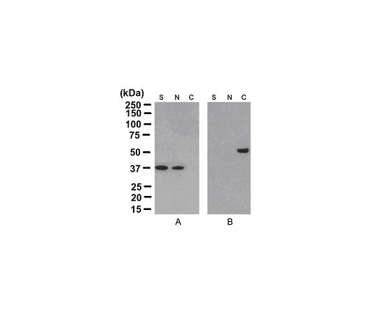 62-8394-44　［已停用］蛋白质提取物 (R) 细胞骨架浓缩和分离试剂盒15反应 (1试剂盒)　17-10195