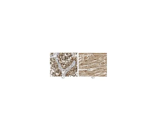 62-8457-15　［已停用］抗PGC-1β　ABC218