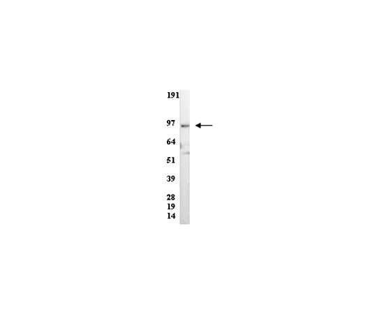 62-8381-70　［已停用］抗PI4-激酶β;200μg　06-578