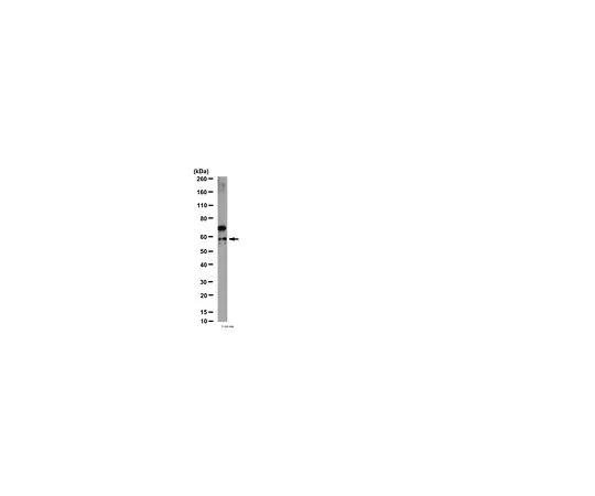 62-8381-07　［已停用］抗组织蛋白酶D;100μg　06-114