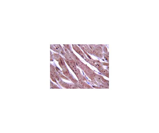 62-8382-88　［已停用］抗DKK2;100μg　06-1087