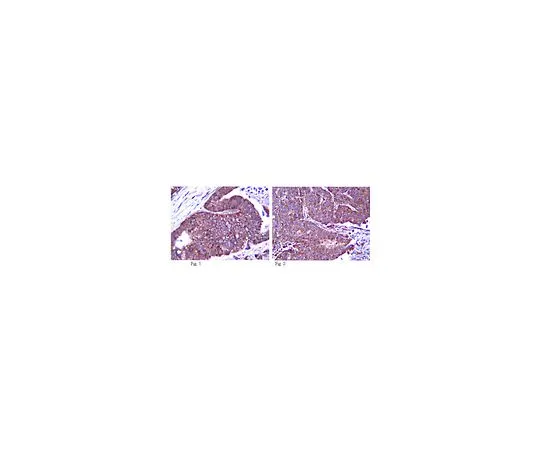 62-8446-68　［已停用］抗ZO-2;100μg　AB2273