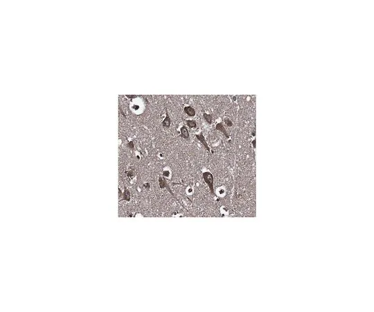 62-8466-65　［已停用］抗LGI2　ABN335