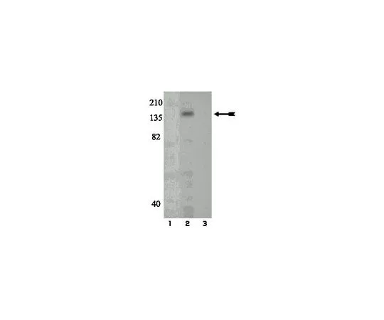 62-8386-65　［已停用］抗磷c-Kit (Tyr721);100μL　07-804
