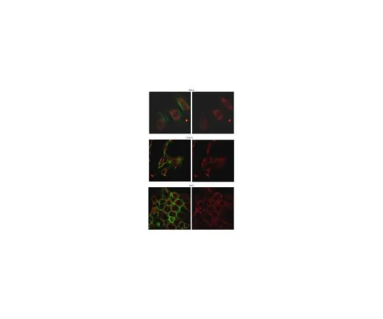 62-8472-80　［已停用］抗Prolin-1;100μg　ABT132