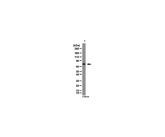 62-8383-22　［已停用］抗TAB1;100μg　06-1336